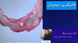 فیلم واقعی قالب گیری دیجیتال