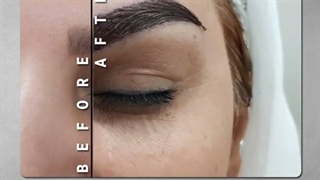 کاشت ابرو طبیعی