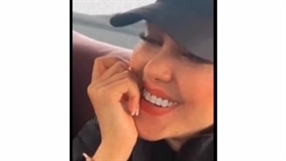 کامپوزیت دندان