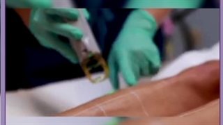 کلینیک زیبایی در جردن کشیدن دندان