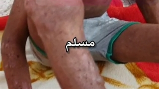 مسلم زاویه سازی صورت
