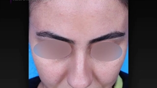 فیلم بدون سانسور عمل زیبایی بینی