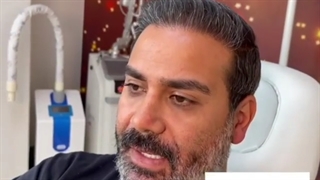 فیلم قبل و بعد عمل بینی مردانه