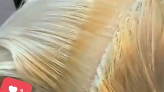 ترمیم دکلره