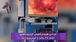 فیلم عمل خارج کردن رحم در خانم 47 ساله
