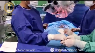 سندروم دیاستماتومیلی