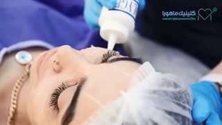فیلم هایفوتراپی برای جوانسازی صورت