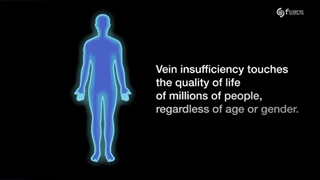 درمان غیر جراحی واریس های عمقی