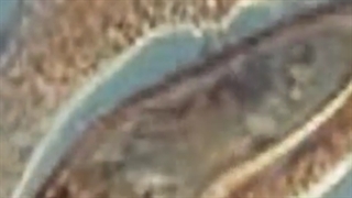 phagocytose 1