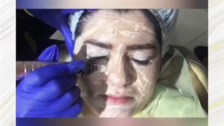 میکروپیگمنتیشن ونک