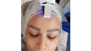 پاکسازی پوست مزوتراپی