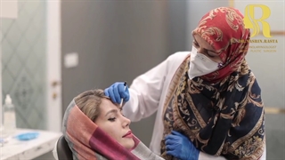 مراجعه مجدد زیباجو بعد از عمل بینی برای تزریق بوتاکس