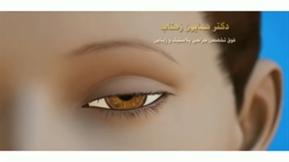 جراحی پلک