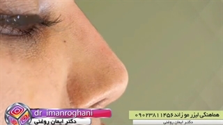 تزریق فیلر بینی کاشت ابرو