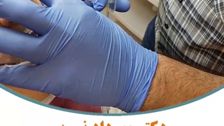 خداحافظی با گودی زیر چشم