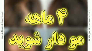 قطع ریزش مو در 4 ماه