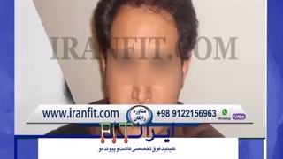 درمانگاه تخصصی کاشت مو ایران FIT اتوپلاستی