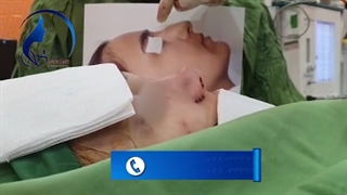 جراحی زیبایی بینی