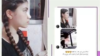 نمونه رضایت زیباجو از بینی خوش فرم و زیبا توسط دکتر الهام یعقوبی کشیدن دندان