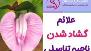 علائم گشاد شدن ناحیه تناسلی کدامند؟