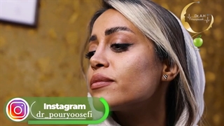 فیلم واقعی از مادلینگ صورت، تزریق فک، گونه و چانه