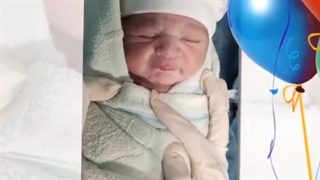 زایمان سزارین تکراری