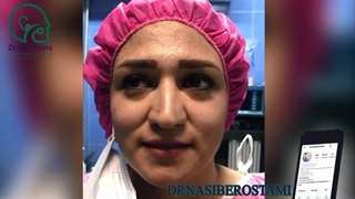 فیلم اتاق عمل بینی گوشتی پهن