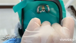 مراجعه مریض درمان ریشه به دکتر نغمه معراجی