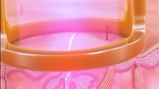 کولینگ الکس