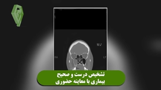 اهمیت مراجعه حضوری برای درمان بیماران مبتلا یا مشکوک به سرطان