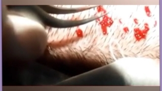 قیمت و هزینه کاشت ابرو طبیعی چقدر است