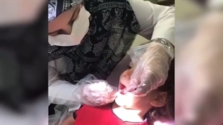 فیلم ترمیم دندان حامی عزیز