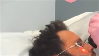 آیا موهای صورت هم می توان لیزر کرد؟ چه عوارضی دارد؟