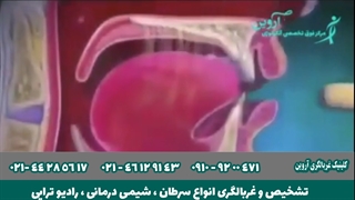 تشخیص سرطان مری | درمان سرطان مری | غربالگری سرطان مری