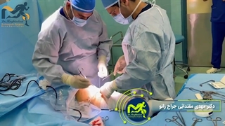 بازسازی رباط صلیبی (ACL) و ترمیم مینیسک