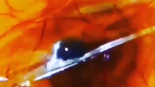 مشاهده جنین داخل تخم مرغ نطفه دار