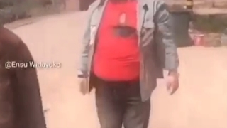 اههم خیلی تعصیر گزار بود@-@پس یاد می گیریم که... جراحی گوش
