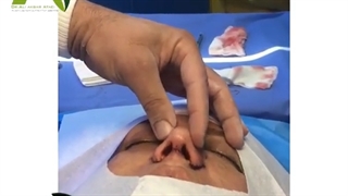 جراحی زیبایی بینی