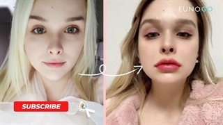 تزریق فیلر لب | 0 تا 100 آنچه که باید درباره تزریق فیلر لب بدانید