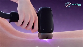 همه چیز درمورد لیزر بیکینی هزینه‌ها، مراحل و نتایج | بیوتکس