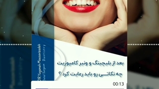 نکاتی که بعد از بلیچینگ و ونیر کامپوزیت باید رعایت شود