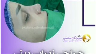 جراحی زیبایی بینی