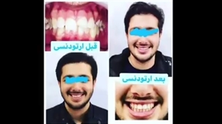 متخصص ارتودنسی دکتر مهدی فهیمی هنزائی