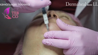 آموزش مزوتراپی لاغری LL درماهیل