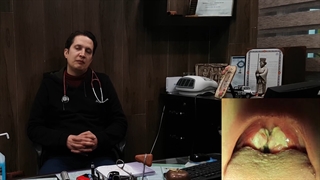 مونو نوکلئوزغفونی