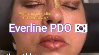 رفع خط های اخم با نخ