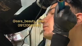 جوانسازی پوست صورت در کلینیک سارا بیوتی #09120660447 جراحی زیبایی پلک