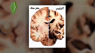 چه زمانی باید به متخصص مغز و اعصاب مراجعه کنیم؟