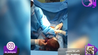 فیلم به دنیا آمدن آرسام کوچولو با زایمان سزارین