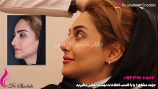 رضایت بیمار بعد از 5 هفته